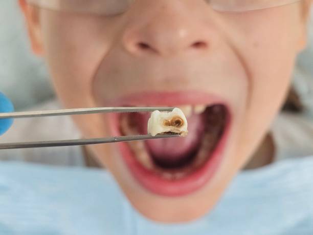 Best Tooth Infection Emergency Dentist  in Park River, ND